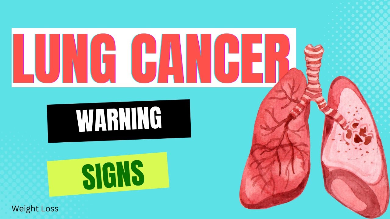 8 Lung Cancer Warning Signs Lung Cancer Symptoms Youtube 