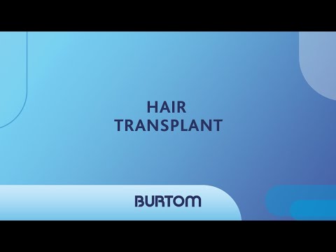 Burtom Hair Transplant