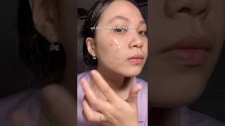 THÂM MỤN LÀM SAO ĐỂ HẾT 😭😭
