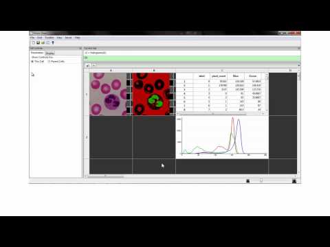 Vision Spreadsheet Overview