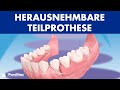 Herausnehmbare Teilprothese ©