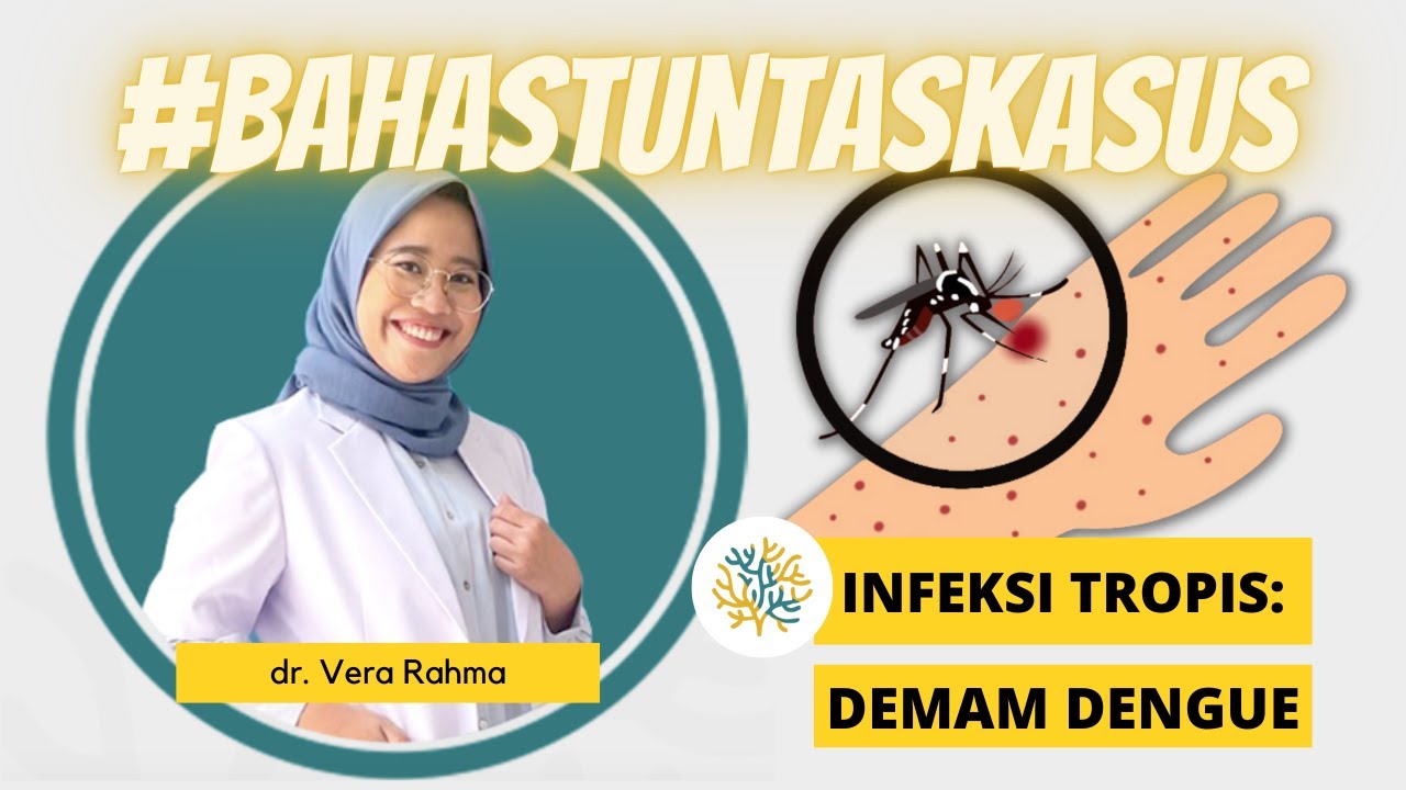 UKMPPD Session #42 | Infeksi Tropis : Dengue Fever (Diagnosis, Pemeriksaan, dan Tatalaksana)