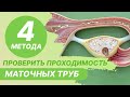 4️⃣​ 4 метода исследования проходимости маточных труб