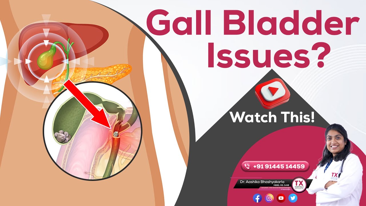 Gall Bladder Issues? Causes, Symptoms & Treatment | Dr. Aashika Bishayakarla || TX Hospitals