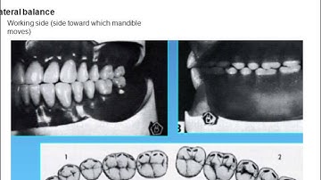 Complete Denture Occlusion