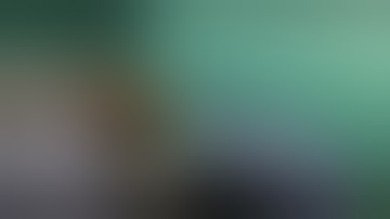 Real-Time Fluorescence (Infrared) Laparoscopy Colon Surgery - Technical description