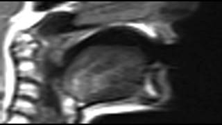Ultrax MRI vl alveolar fricative