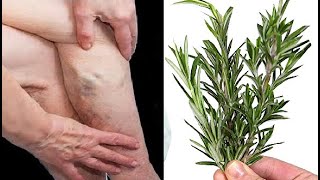 Leg pain, rheumatism, varicose veins, arthritis, headaches, joint pain. Mom's natural remedies