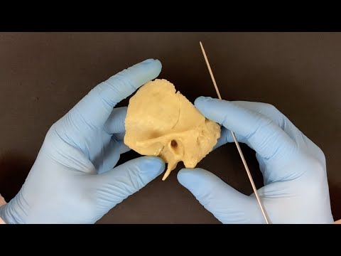 Височная кость (превью) - Os temporale (анатомия человека)