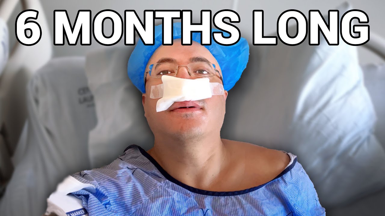 The Truth About Nose Surgery - Septoplasty