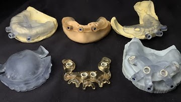 Surgical guide bone reduction guide stackable guide CoDiagnostiX @arklign8978