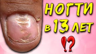 ДЫРКА в ногте! ❌ МАСТЕР МАНИКЮРА В 13 ЛЕТ?!😱 Наращивание Ногтей ШКОЛЬНИЦЕ. Испортила Ногти.GEL NAILS