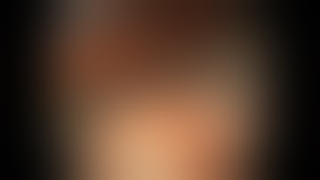 Colonoscopy: Ascending Colon - Large EMR