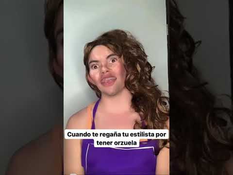 Tú estilista te regaña por tener orzuela