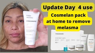 Day 4 update used Cosmelan 2 how to use the cream