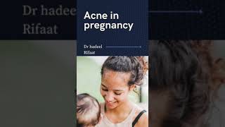 shorts treatment of acne during pregnancy
