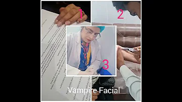 #prpface #vampirefacial #melasma #darkspots #freckles #skinglow #dullskin #collagen