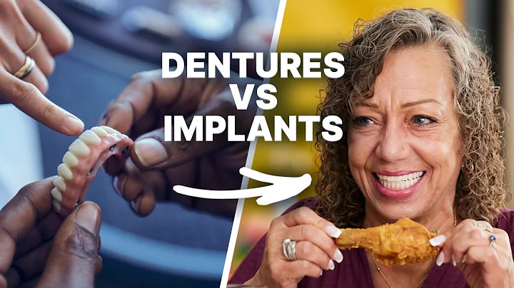 Dentures vs. Implants: The Truth About Your Best Option in 2025