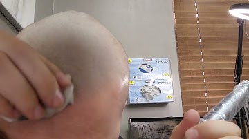 SMP on self!  Sneak preview of new pigment that will not blow out. primarily made for scars, no blur