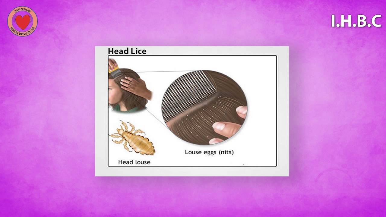 Head & Pubic Lice YouTube