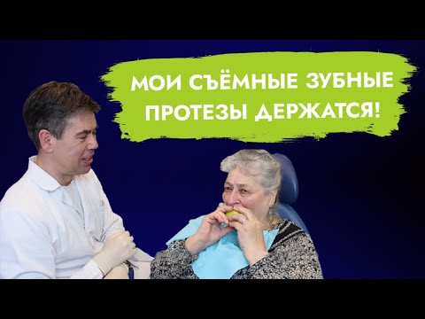 Почему не держится съёмный протез? А у меня держится!