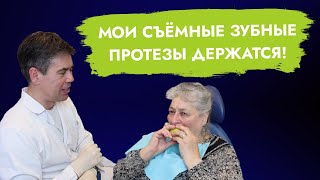 видео: Почему не держится съёмный протез? А у меня держится! картинка: Почему не держится съёмный протез? А у меня держится!