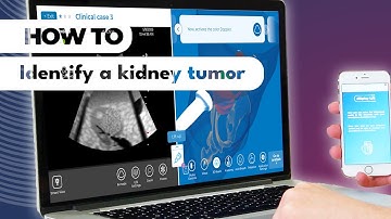 #howto characterize a renal tumor in diSplay U/S simulator