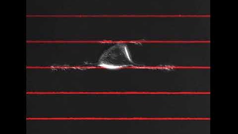 Cancer cell movement in microenvironments