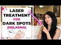 Laser Treatment for Dark Spots Melasma