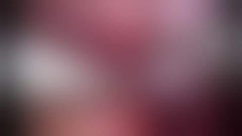 Technical and Technological innovations of pure laparoscopic hepatectomy, especially for the tumor l