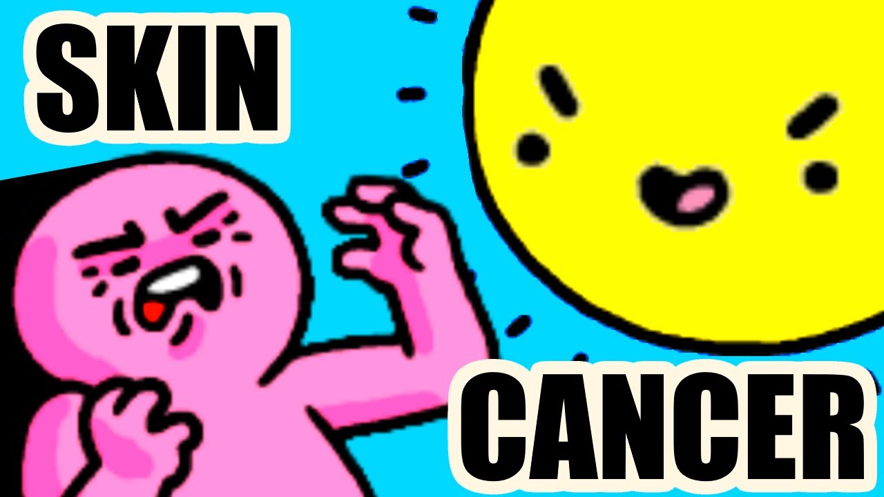 Рак кожи — комикс мистера Ловенштейна