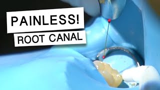 Root Canal Treatment is NOW PAINLESS with a LASER! 😁