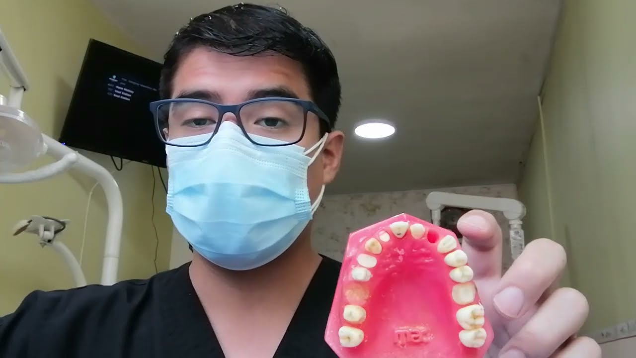 Endodoncia en premolar inferior : Secuencia de tratamiento de conducto (1° parte)