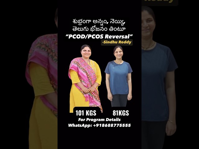 Sindhu Reddy’s , PCOS reversal and 20 kg weight loss. WhatsApp on +918688775555 for more details