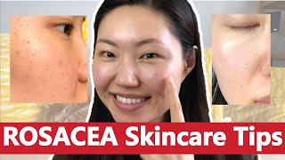 Skincare Recommendation for ROSACEA: Calming Redness and Irritation