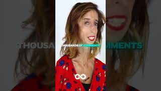 Ugliest Woman People Called Her....