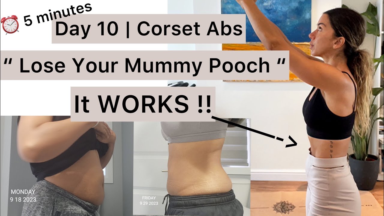 Day 10  Corset Abs training to “ lose your mummy pooch “. It Works!  Diastisis recti repair. 