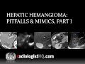 Hepatic Hemangioma: Pitfalls & Mimics, Part I