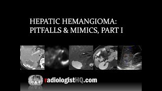 Hepatic Hemangioma: Pitfalls & Mimics, Part I