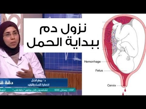 الدم الحمل نزول بداية نزول كتل