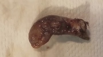 Another Appendix