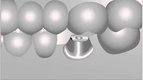 Ankylos TitaniumBase animation