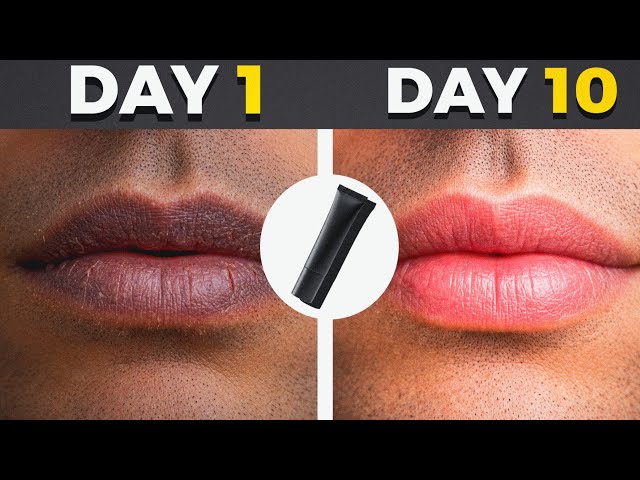 Turn Your Dark Lips Into Pink Smooth Lips (Full Guide) Get Rid of Dark Lips