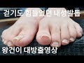 [시원함주의!!]😄왕건이 대방출영상!!👍고객님 발톱 갈면서 웃음터지심!!😄(ingrown toenail/toenails with fungus)