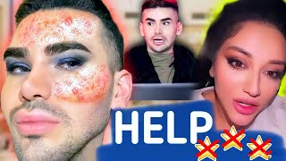 видео: 🚫ПОПАЛ В БОЛЬНИЦУ / ИЗУРОДОВАЛИ ЛИЦО / ГОАР АВЕТИСЯН makeup / ТРЕШ САЛОН ЛЕТА ЧАСТЬ 2 / ДЯДЕНЬКА TEO картинка: 🚫ПОПАЛ В БОЛЬНИЦУ / ИЗУРОДОВАЛИ ЛИЦО / ГОАР АВЕТИСЯН makeup / ТРЕШ САЛОН ЛЕТА ЧАСТЬ 2 / ДЯДЕНЬКА TEO