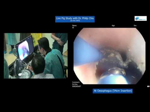 EndoscopicEndoscopicManagement of Upper GI Bleeding Dennis Jensen, MD, UCLA 6th Annual UCLA-Mellinko. EndoscopicEndoscopicManagement of Upper GI Bleeding Dennis Jensen, MD, UCLA 6th Annual UCLA-Mellinko.