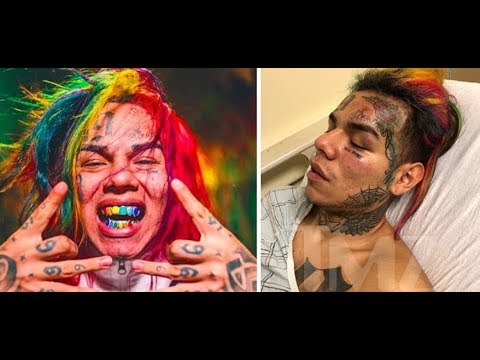6ix9ine speaks out for the first time 'I was Knocked Unconscious TWICE, IT WAS A INSIDE JOB' 