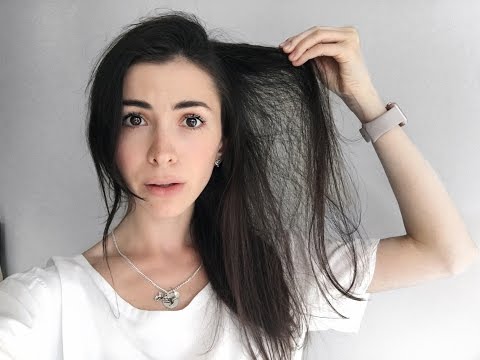 My HAIR LOSS Story - How I Fought It + Hair Growth Tips