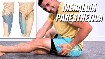 Tingling, or numbness Outer Thigh - Meralgia Paresthetica You Need to Know!