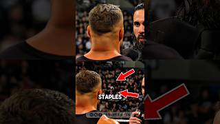 Did you catch the STAPLES in Bron Breakker’s head on Raw?! 😨 #wwe #wweraw